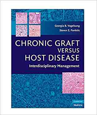 Chronic Graft Versus Host Disease: Interdisciplinary Management
