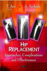 Hip Replacement