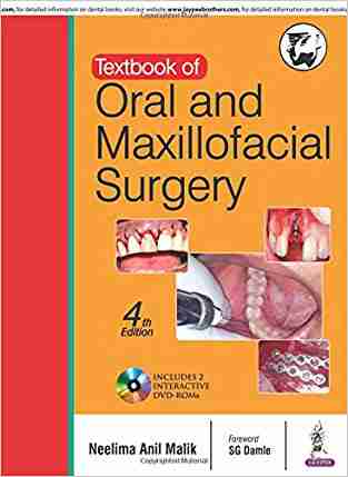 Textbook of Oral and Maxillofacial Surgery