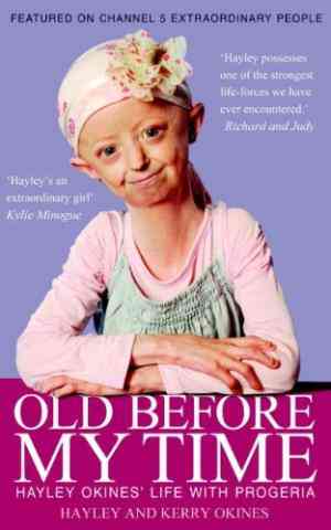 Old Before My Time: Hayley Okines' Life With Progeria