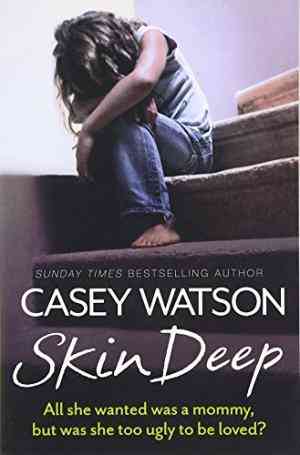 Skin Deep: All She Wanted Was A Mummy, But Was She Too Ugly To Be Loved?