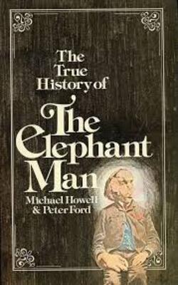 The true history of the Elephant Man
