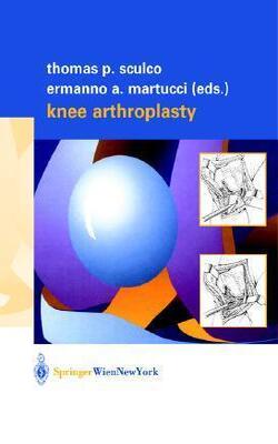 Knee Arthroplasty