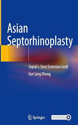 Asian Septorhinoplasty Septal L Strut Extension Graft (hb 2025)
